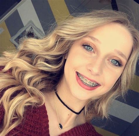 Braces girl : r/bracesgirlr